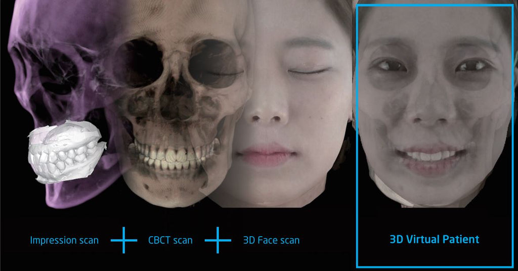 A superimposed photo of several scans using the Rayscan Studio CBCT resulting in a 3D virtual patient image