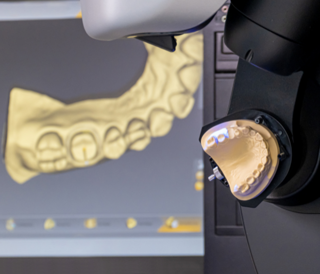 Benefits of CAD/CAM Technology in Dental Restorations