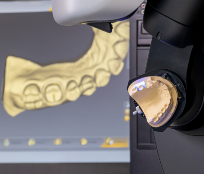 Benefits of CAD/CAM Technology in Dental Restorations – Voxel Dental