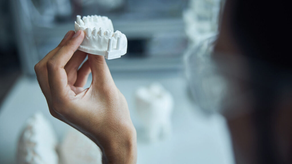 3D Printing Importance in Digital Dentistry