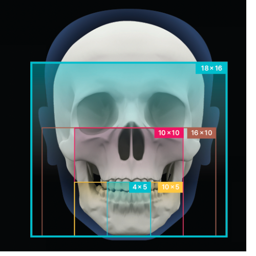RAYScan Vision 18 3D CBCT – Voxel Dental