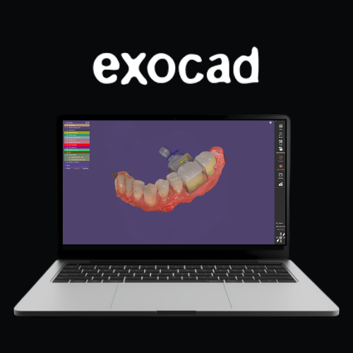 exocad CAD/CAM Design Software – Voxel Dental
