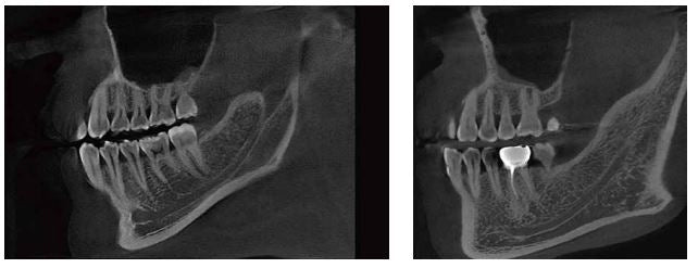Rayscan Vision 16 3D Dental X-Ray | Voxel Dental