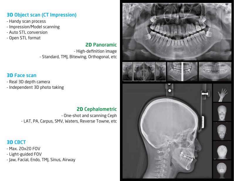 An x-ray of a person's head and jaw comparing the Rayscan Studio's 2D and 3D imaging