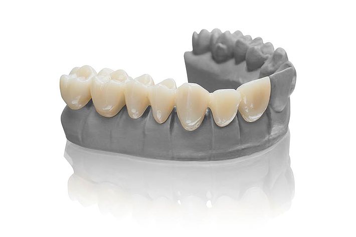 Buy BEGO 3D Printing Resin Online | Voxel Dental